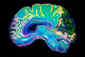 مگنتیت‌های آلوده از قسمت فوقانی بینی به قشر پیشانی به مغز وارد می‌شوند