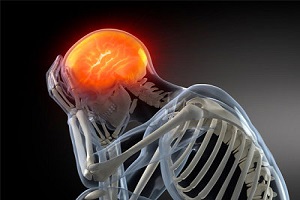 سردردها می توانند از عوارض جانبی یک آسیب مغزی تروماتیک باشند 